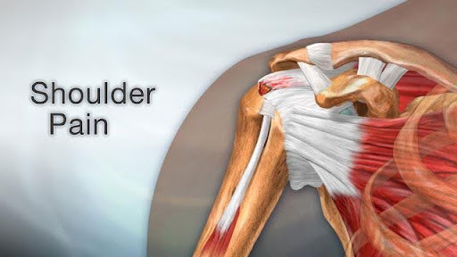 Causes and Symptoms of Shoulder Pain