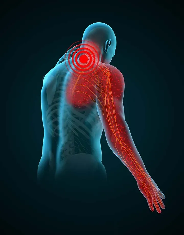 Cause of Shoulder Pain