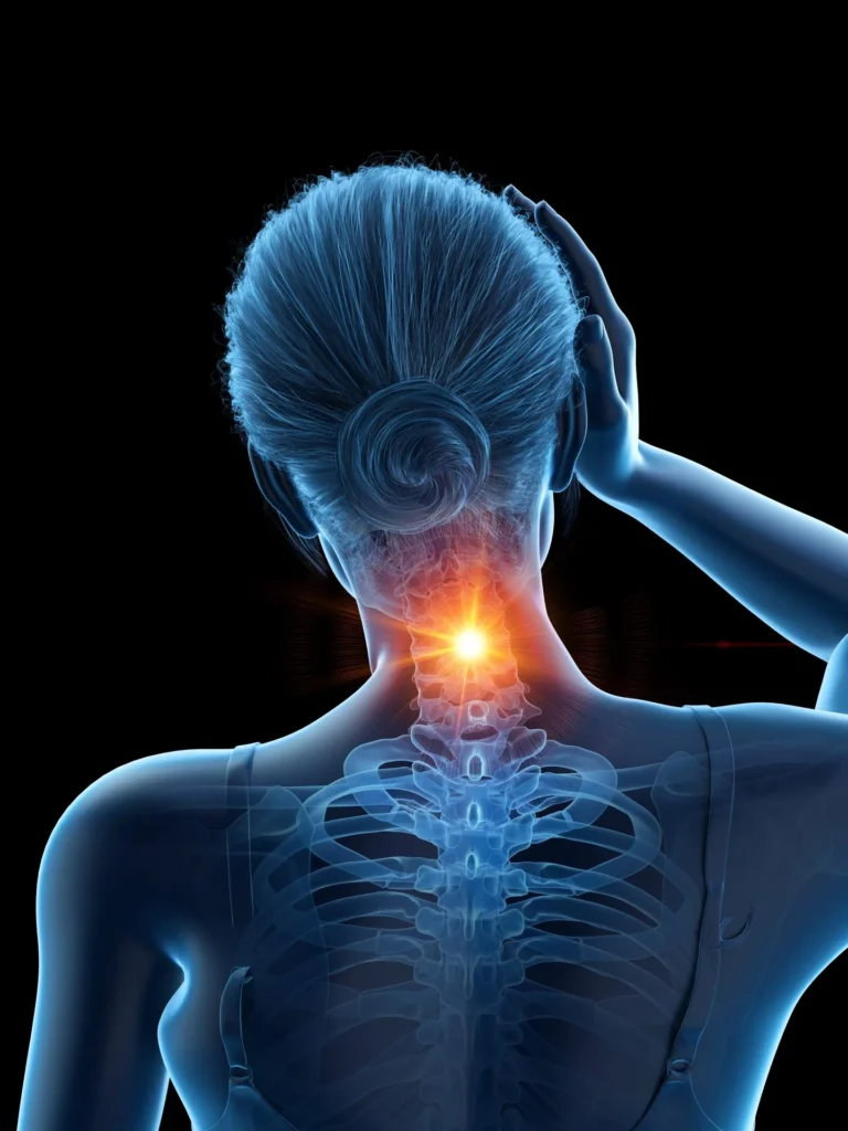 Headaches