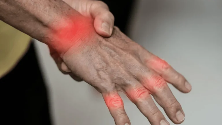 Wrists & Hands