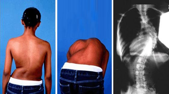 Congenital Disorders