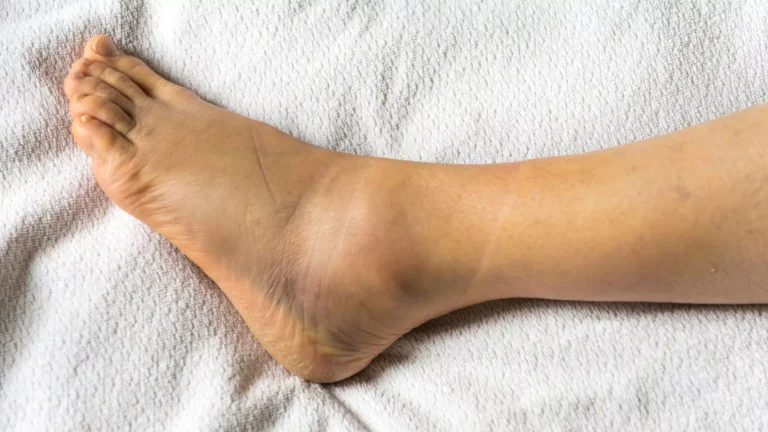 Injuries and Trauma