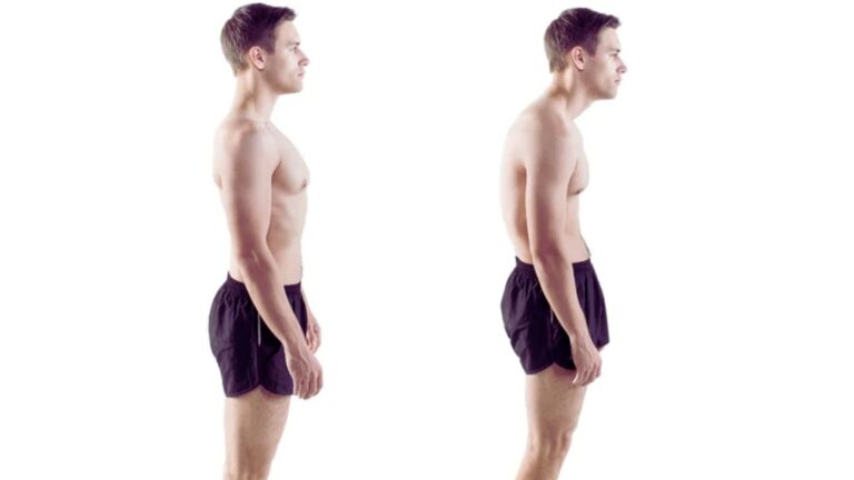 Poor Posture