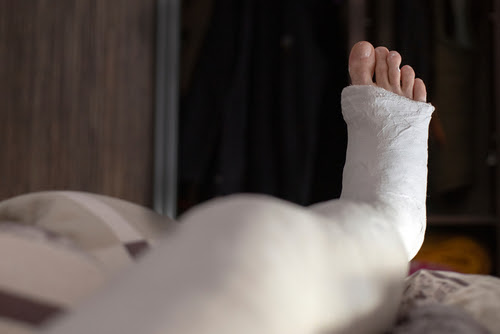 Past injuries
